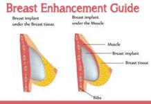 Breast Enhancement Guide