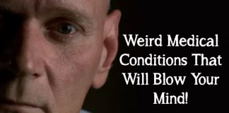 Weird Medical Conditions That Will Blow Your Mind!