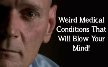 Weird Medical Conditions That Will Blow Your Mind!