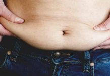 5 Things Which Can’t Be Fixed Even After You Lose Weight