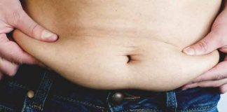 5 Things Which Can’t Be Fixed Even After You Lose Weight